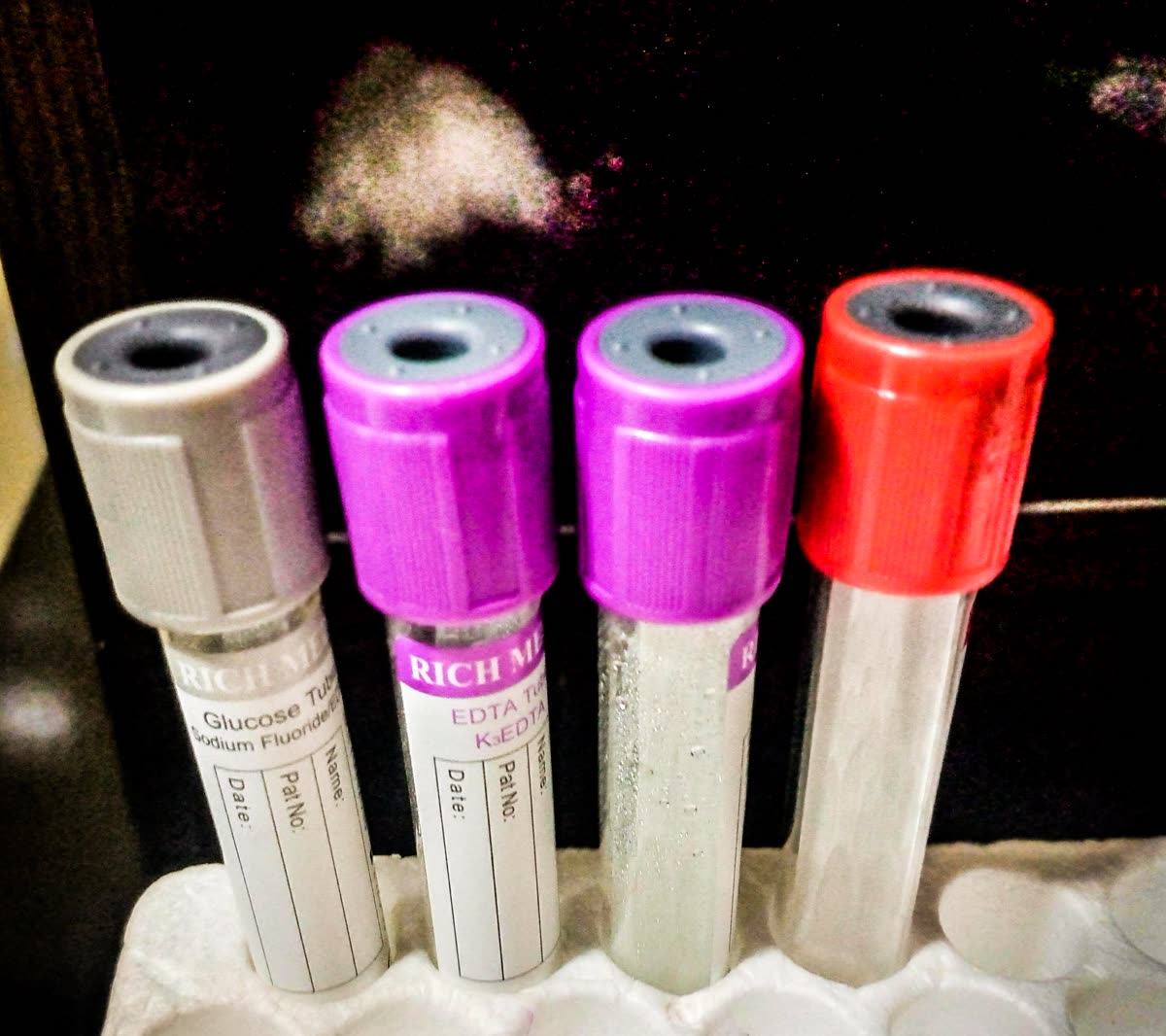 Laboratory Test Tubes; from a medical laboratory in Abuja, Nigeria — 연구 결과가 도달한 단계 — 시험관과 세포까지