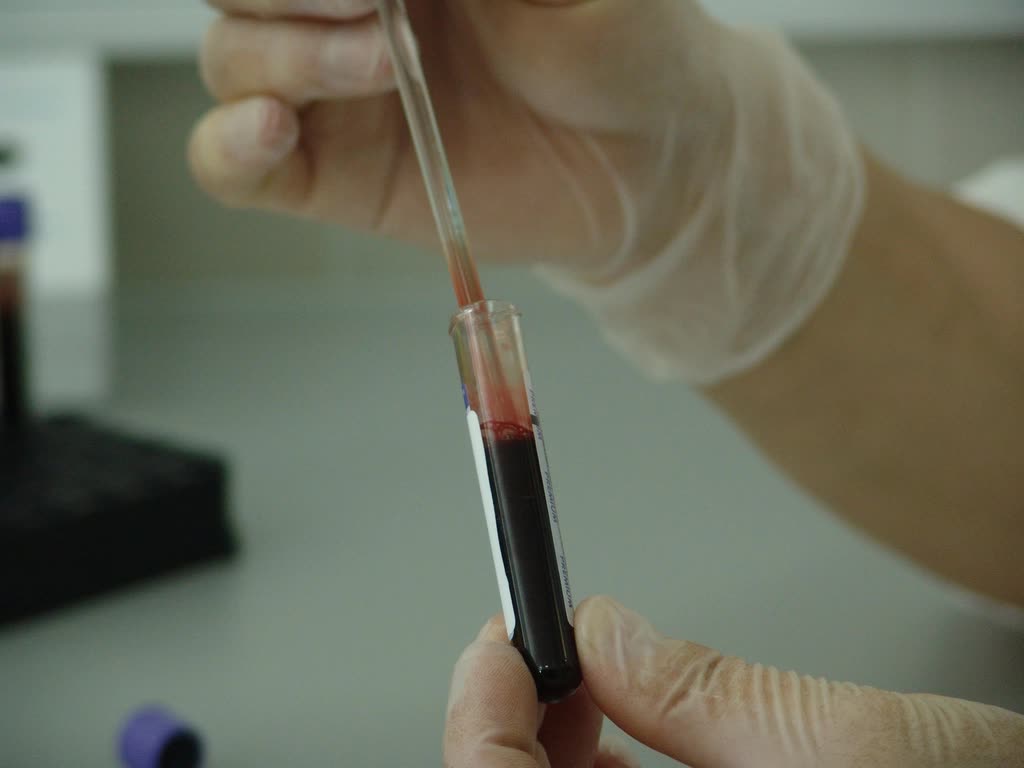 Free blood sample tube image — 105명 84일 임상, 혈중 COMP 8.0% 감소로 연골 지표를 봤다